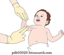 Drawing demonstrating taking a brachial pulse in a child.