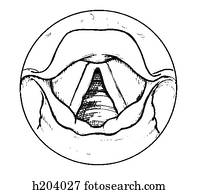 drawing of uterus and ovaries