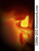 Fötus, Gesundheit, Anfang, Schwangerschaft, Gebärmutter