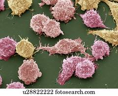 Cancer cells, SEM