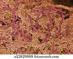 dental, placa, without