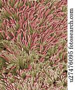 dental, placa, without