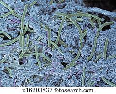 dental, placa, without