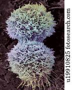 Dividing cervical cancer cell, SEM