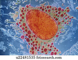 Mast cell, TEM
