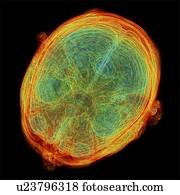 cérebro humano, 3D-MRI, varredura