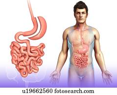 Sleeve gastrectomy, illustration