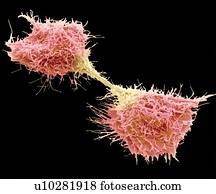 Dividing fibrosarcoma cells, SEM