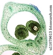 marigold pântano, carpel, micrograph leve