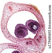 marigold pântano, carpel, micrograph leve
