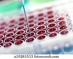 automatizado, sangue, examine