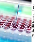 automatizado, sangue, screening.