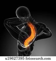 Back pain, conceptual computer artwork. Back pain, conceptual computer artwork.