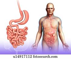 Sleeve gastrectomy, illustration