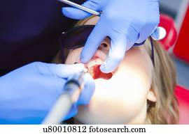 criança, em, dentista