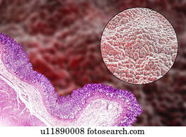 Stomach mucosa, light micrograph and illustration