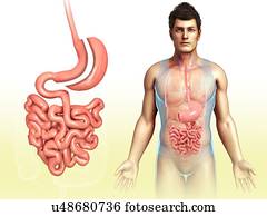 Sleeve gastrectomy, illustration