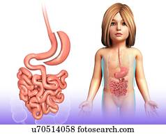 Sleeve gastrectomy, illustration