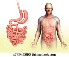 Sleeve gastrectomy, illustration