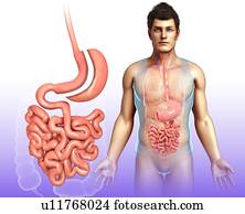Sleeve gastrectomy, illustration