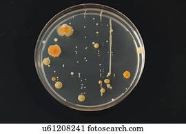 culturas, crescendo, ligado, petri, dish.