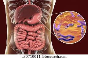 Helicobacter pylori bacteria. Computer illustration of Helicobacter pylori bacteria in a human stomach. Formerly known as Campylobacter pyloridis, these are spiral-shaped Gram-negative bacteria. The terminal flagella (hair-like structures) are used...