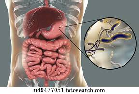 Helicobacter pylori bacteria. Computer illustration of Helicobacter pylori bacteria in a human stomach. Formerly known as Campylobacter pyloridis, these are spiral-shaped Gram-negative bacteria. The terminal flagella (hair-like structures) are used...