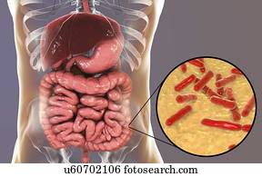 Illustration of Bifidobacterium bacteria in the human intestine. This Gram-positive anaerobic bacteria is the main component of the human large intestine microbiome. It has a unique hexose (sugar) metabolism, called the bifid shunt, which can be used...