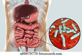Illustration of Bifidobacterium bacteria in the human intestine. This Gram-positive anaerobic bacteria is the main component of the human large intestine microbiome. It has a unique hexose (sugar) metabolism, called the bifid shunt, which can be used...