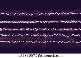 ondas cérebro, em, acordado, estado, com, mental, atividade, computador, illustration., um, electroencephalogram, (EEG), medidas, elétrico, atividade, em, a, cérebro, usando, eletrodos, anexado, para, a, scalp., vário, desordens, lata, ser, diagnosed, por, analisar, eeg, results.