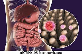 Rotaviruses infecting intestine, computer illustration. The virus particle consists of an RNA (ribonucleic acid) core surrounded by a triple layered capsid. Rotaviruses are probably the most common viruses to infect humans and animals. They are...