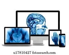 X-ray images on digital device screens.