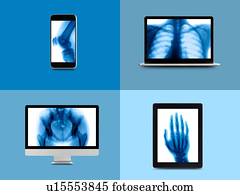 X-ray montage on digital device screens.