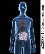 Illustration of an old man's small intestine.