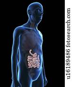 Illustration of an old man's small intestine.