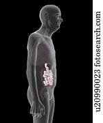 Illustration of an old man's small intestine.