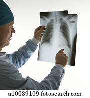Mid-adult Caucasian male doctor pointing at an x-ray.