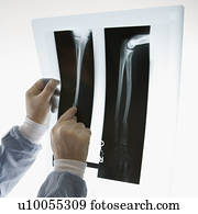 Mid-adult Caucasian male doctor pointing at an x-ray.