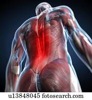 Back pain, conceptual artwork Back pain, conceptual artwork