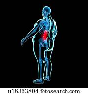 Back pain in obesity, conceptual artwork Back pain in obesity, conceptual artwork