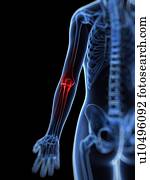 Elbow pain, conceptual artwork