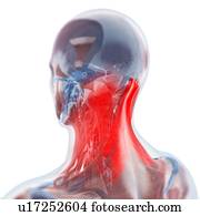 Neck pain, conceptual artwork