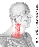 Neck pain, conceptual artwork