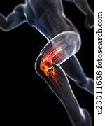 executando, ferimento, conceitual, artwork