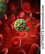 Hepatitis E infection, artwork