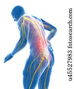 Back pain, artwork Back pain, artwork