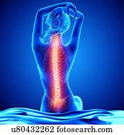 Back pain, artwork Back pain, artwork