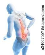 Back pain, artwork Back pain, artwork