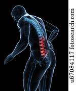 Back pain, artwork Back pain, artwork