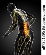 Back pain, artwork Back pain, artwork